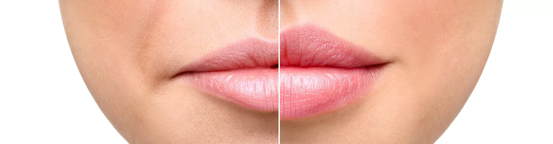 Russian lips orosz technika