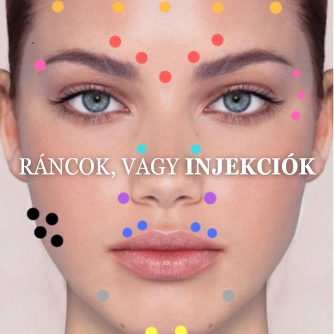A B.0.T.0.X technika finomhangolása