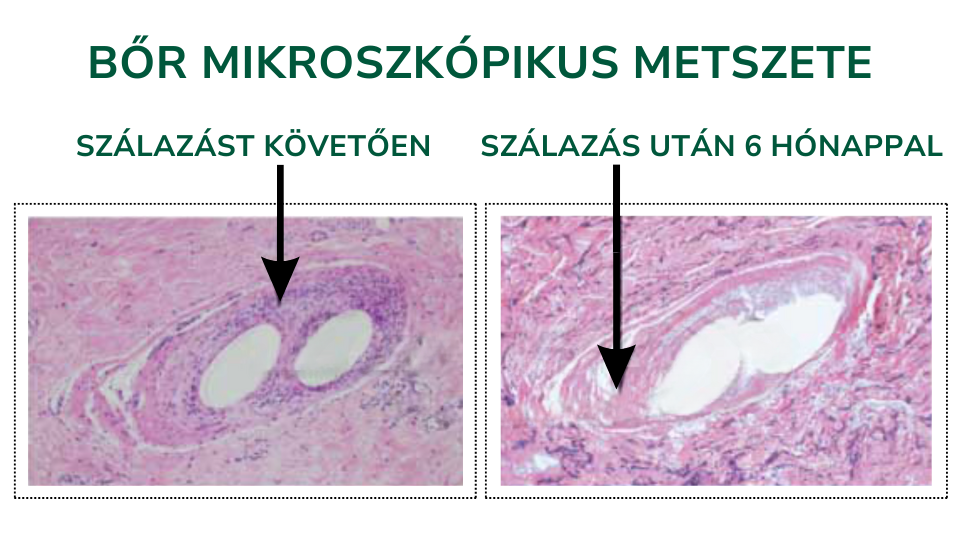 a bőr mikroszkópikus metszete