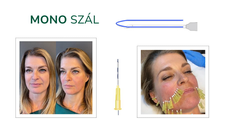 mono szál