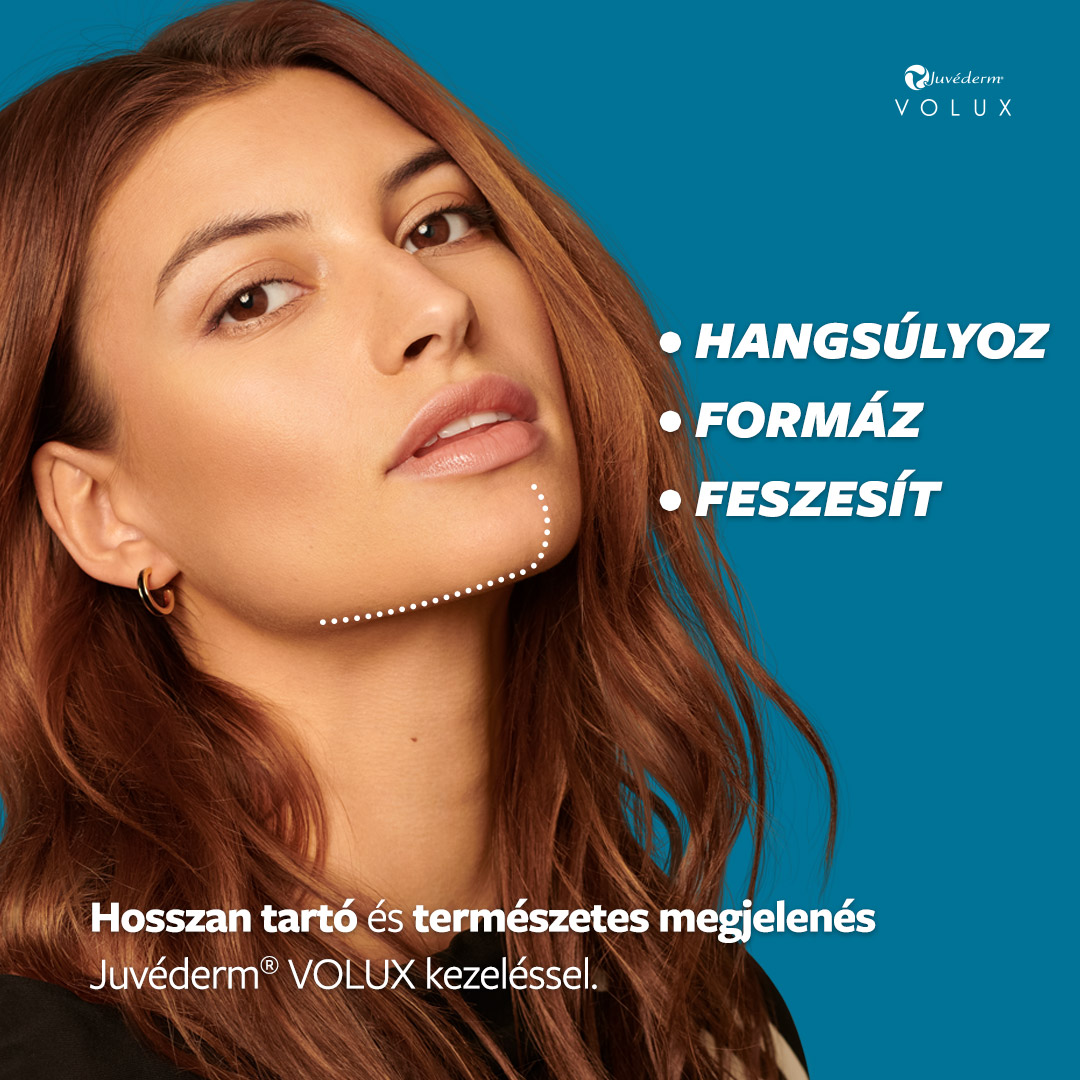 Juvéderm VOLUX ®Állvonal kontúrozás