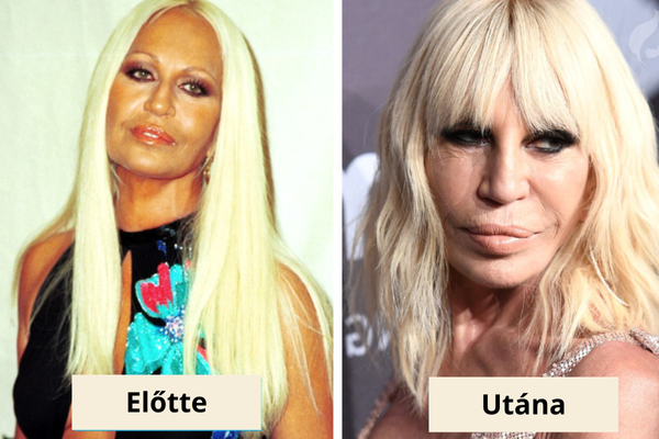 Donatella Versace Donatella Versace plasztika