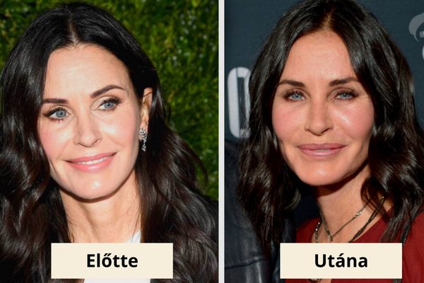 Courtney Cox plasztika Courtney Cox plasztika