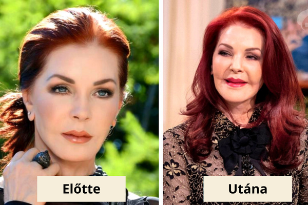 Priscilla Presley plasztika Priscilla Presley plasztika