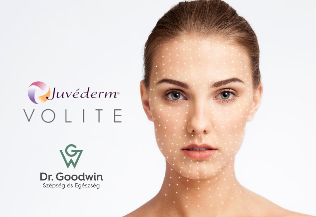 Juvederm Volite