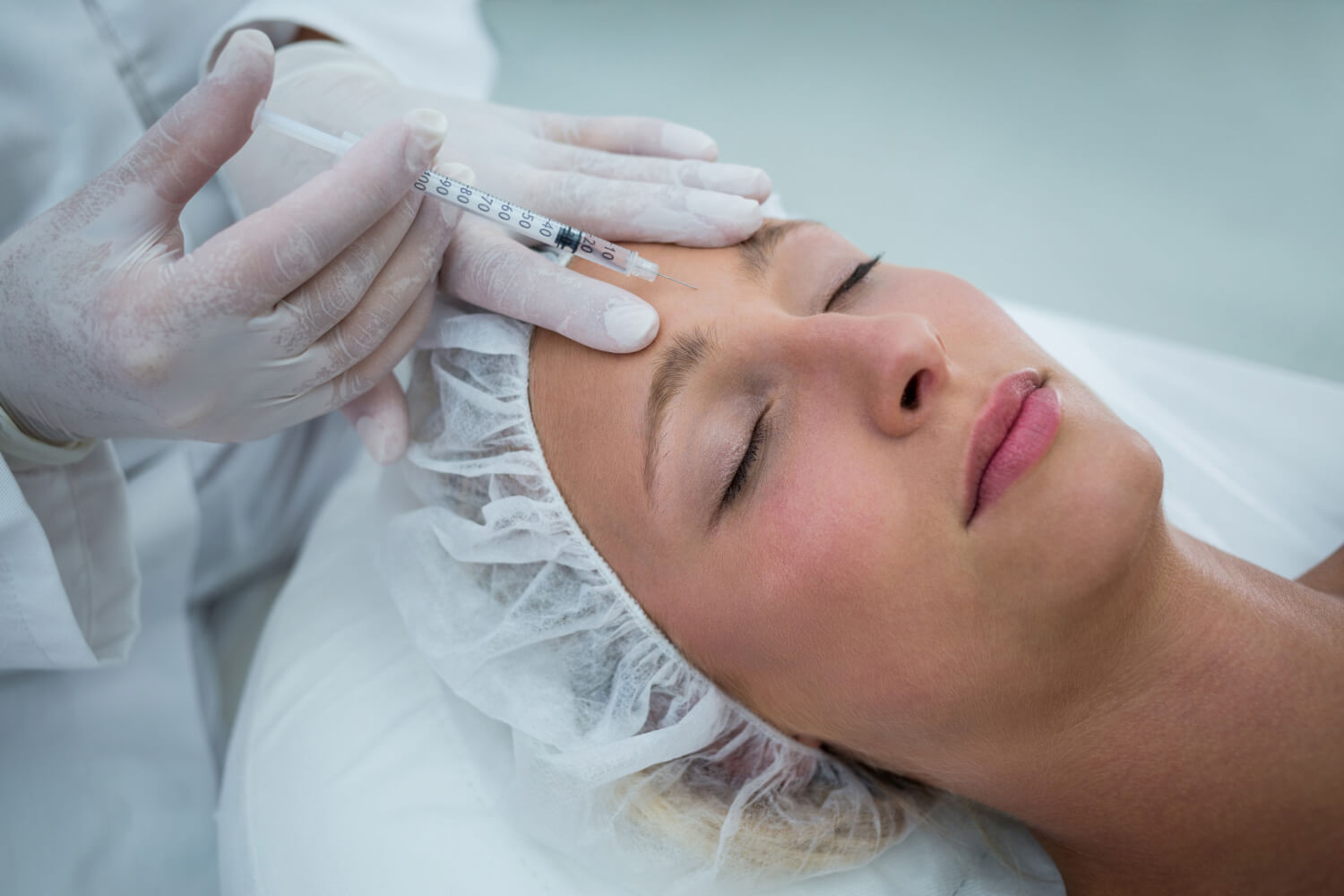 Mikor kezd hatni a botox? Néhány napra szükség van az eredményhez.