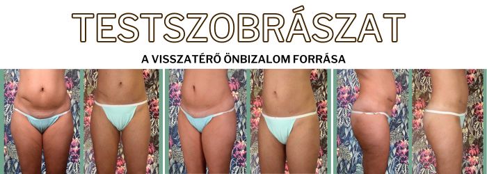 testszobrászat testszobrászat